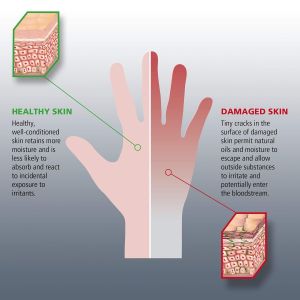 Hand Medic Professional Skin Conditioner 150ml
